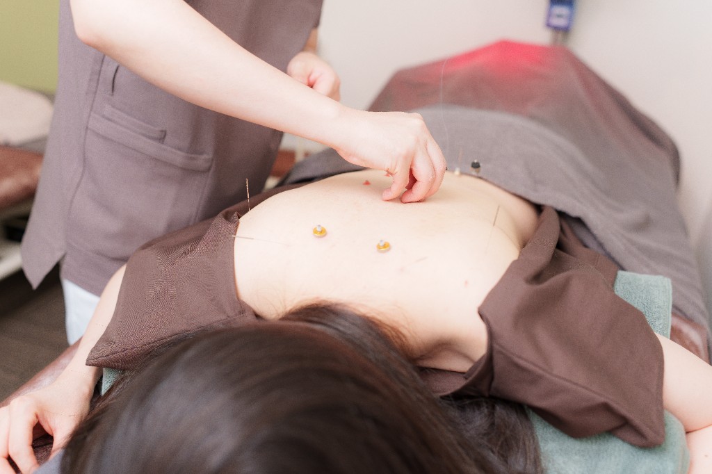 専用の施術着に着替え、うつ伏せで鍼灸・お灸の施術を受けている様子。
