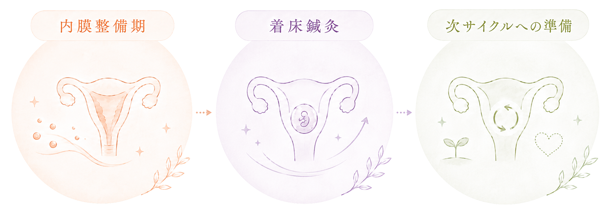 移植サイクルに合わせた鍼灸ケア:移植前周期(内膜整備期)、移植前後(着床鍼灸)、移植後・次サイクルへの準備
