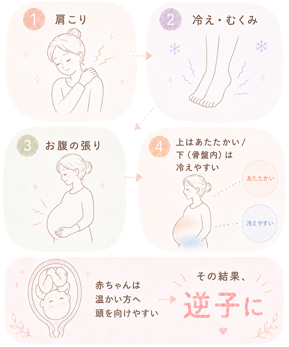 逆子の原因を4ステップで説明するイラスト。肩こり、冷え・むくみ、お腹の張り、上下の温度差により、赤ちゃんが温かい方へ頭を向けて逆子になる流れ。
